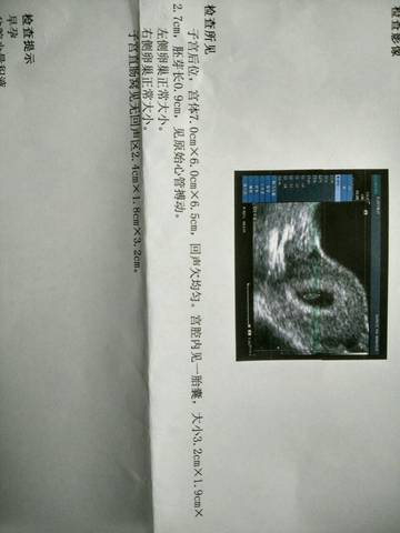 journal_insert_pic_831531356