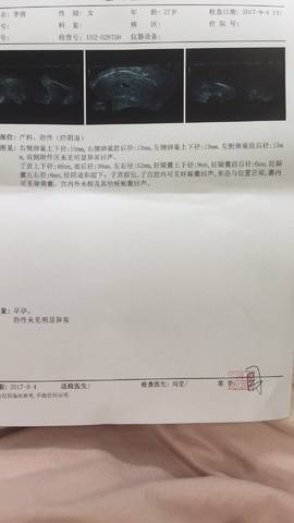 journal_insert_pic_831706116