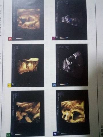 journal_insert_pic_831910282