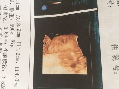 journal_insert_pic_833296303