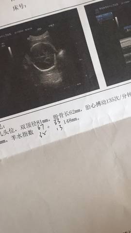journal_insert_pic_833063055