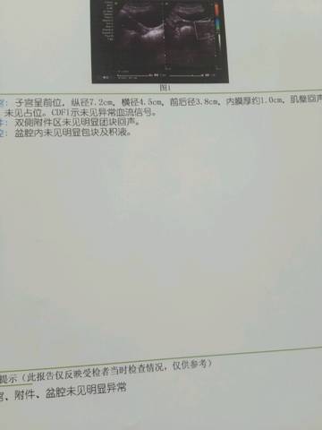 journal_insert_pic_834304386