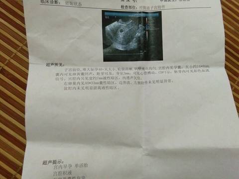 journal_insert_pic_834470442