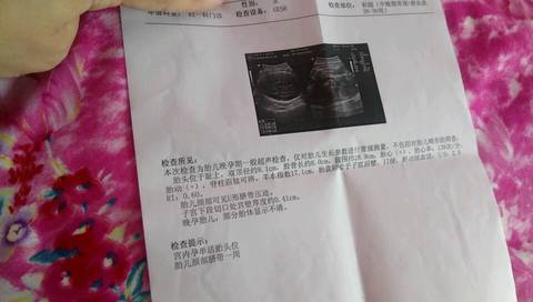journal_insert_pic_834907395