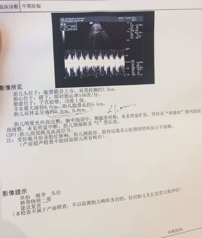 journal_insert_pic_836053214