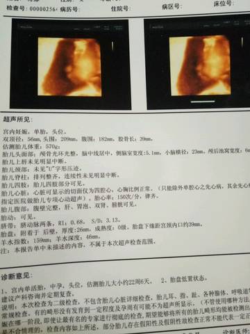journal_insert_pic_835548274