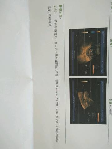 journal_insert_pic_836574710