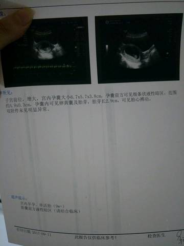 journal_insert_pic_838141166