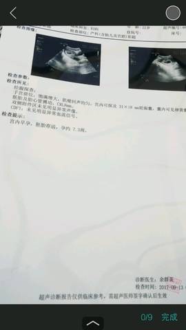 journal_insert_pic_837855595