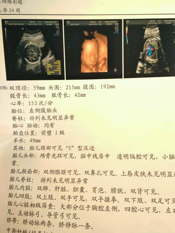 journal_insert_pic_838705944
