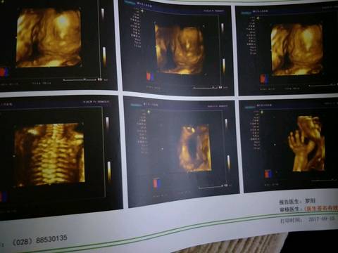 journal_insert_pic_839532557
