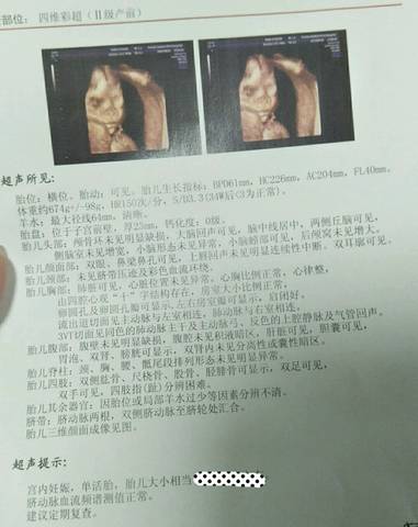 journal_insert_pic_840388470