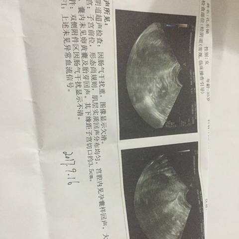 journal_insert_pic_840215763