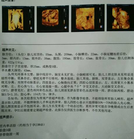 journal_insert_pic_843205879