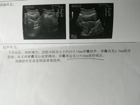 journal_insert_pic_843203430
