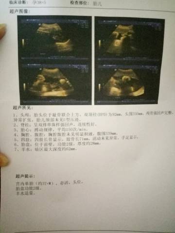 journal_insert_pic_844125048