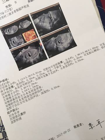 journal_insert_pic_844559474