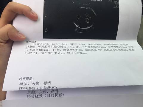 journal_insert_pic_846659311