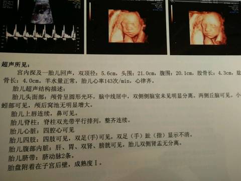 journal_insert_pic_846609389