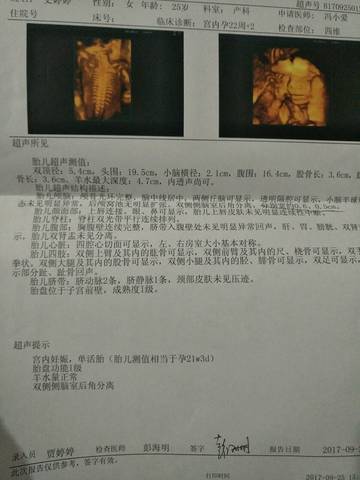 journal_insert_pic_848423681