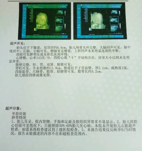 journal_insert_pic_848482668