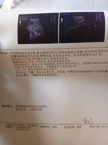 journal_insert_pic_849086075