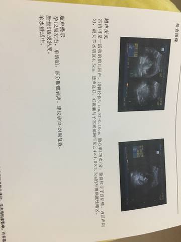 journal_insert_pic_849773133