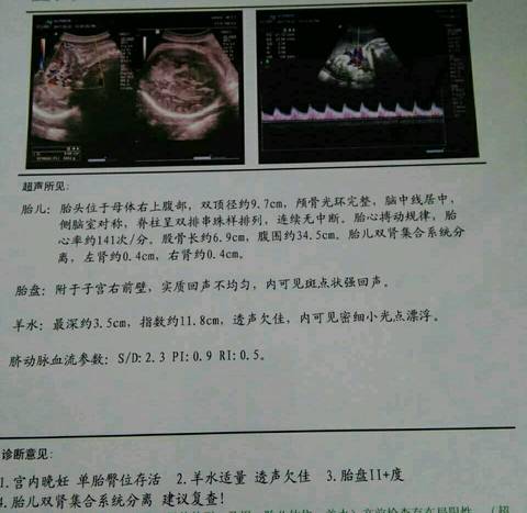 journal_insert_pic_850399204