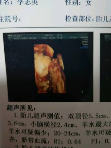 journal_insert_pic_856101087