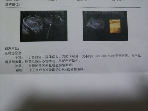 journal_insert_pic_857987294