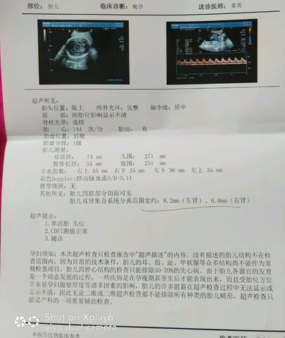 journal_insert_pic_860350038