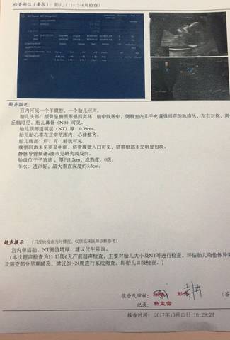 journal_insert_pic_860804885