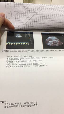 journal_insert_pic_861807566