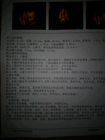 journal_insert_pic_862583938