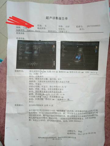 journal_insert_pic_863230042