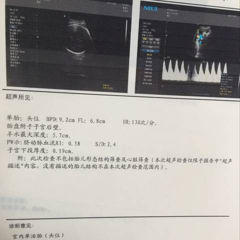 journal_insert_pic_865886416