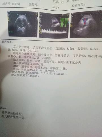 journal_insert_pic_866805273