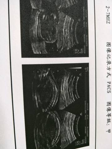 journal_insert_pic_866565102