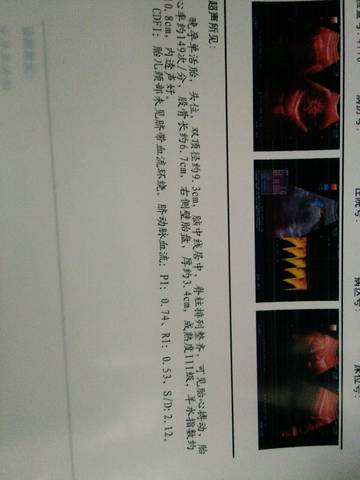 journal_insert_pic_867316949
