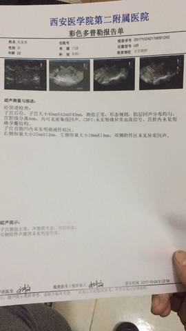 journal_insert_pic_869331050