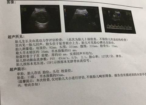 journal_insert_pic_868833491