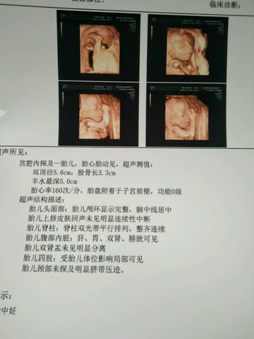 journal_insert_pic_871360357