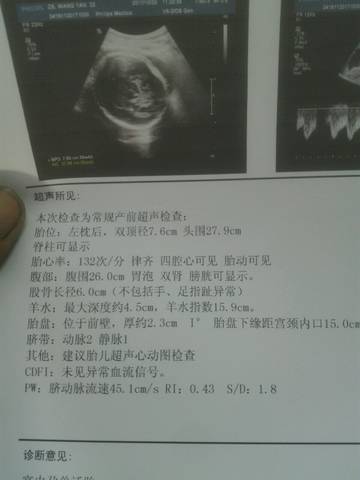journal_insert_pic_873207387
