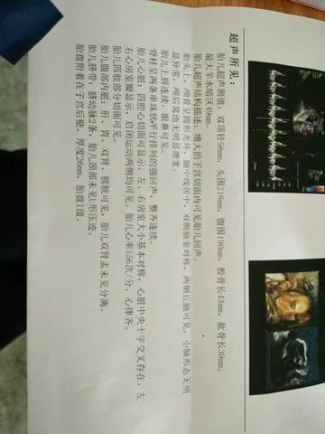 journal_insert_pic_873955094
