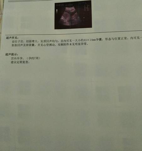 journal_insert_pic_874659938
