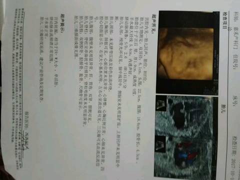 journal_insert_pic_875331932