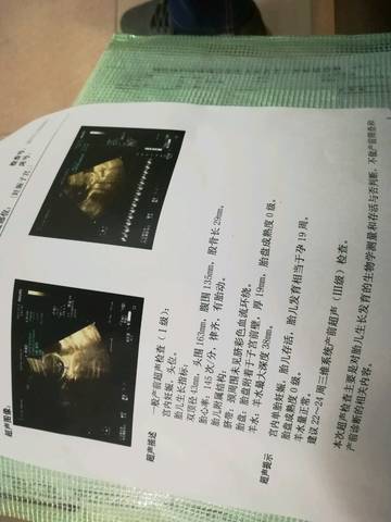 journal_insert_pic_876240993