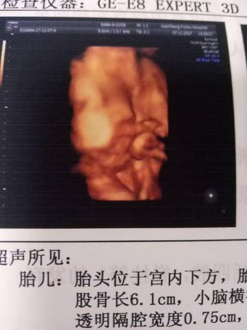 journal_insert_pic_879257283