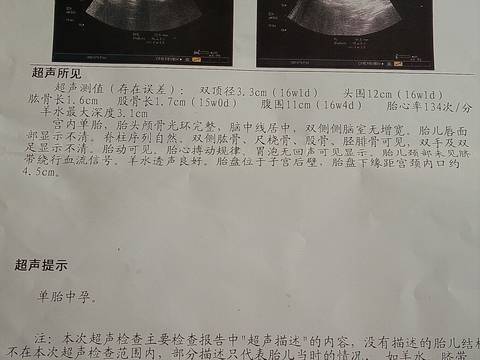 journal_insert_pic_880491157