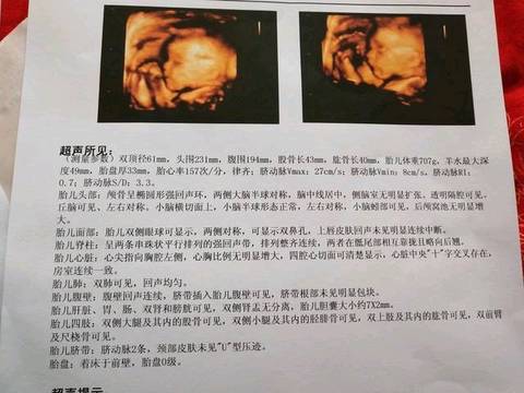 journal_insert_pic_880429591